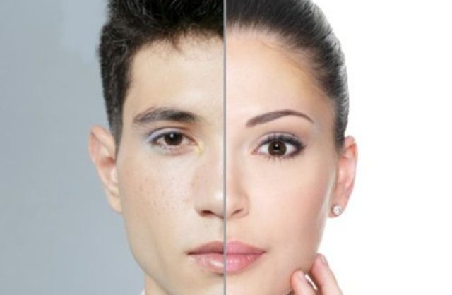 Gender Change Surgery: Procedure, Benefits, Risks, and Recovery